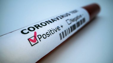 Yeni Corona virüsü enfeksiyonu teşhisi için pozitif COVID-19 testi ve laboratuvar örneği. Wuhan 'dan 2019 numaralı hastalık. Salgın bulaşıcı konsept. 2019-NCoV Çin salgını.
