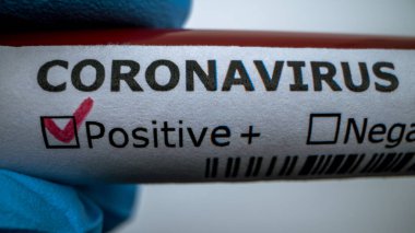 Yeni Corona virüsü enfeksiyonu teşhisi için pozitif COVID-19 testi ve laboratuvar örneği. Wuhan 'dan 2019 numaralı hastalık. Bulaşıcı salgın konsepti
