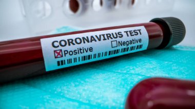 Koruyucu maske ve pozitif COVID-19 testi. Yeni Corona virüsü enfeksiyonu teşhisi için laboratuvar kan testi. Wuhan 'dan 2019 numaralı hastalık. Bulaşıcı salgın konsepti