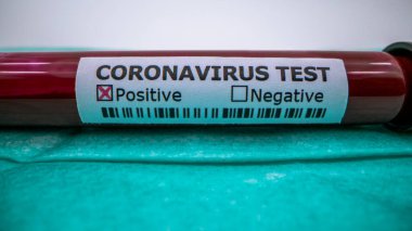 Yüz maskesi ve COVID-19 için enfekte kan örneği içeren test tüpü. Wuhan, Çin 'de bulunan yeni bir koronavirüs. Koruma için mavi eldivenli bilim adamı. 2019-NCoV virüsü için aşı araştırması