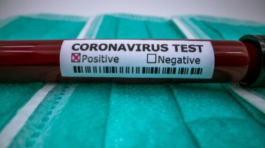 Yüz maskesi ve COVID-19 için enfekte kan örneği içeren test tüpü. Wuhan, Çin 'de bulunan yeni bir koronavirüs. Koruma için mavi eldivenli bilim adamı. 2019-NCoV virüsü için aşı araştırması