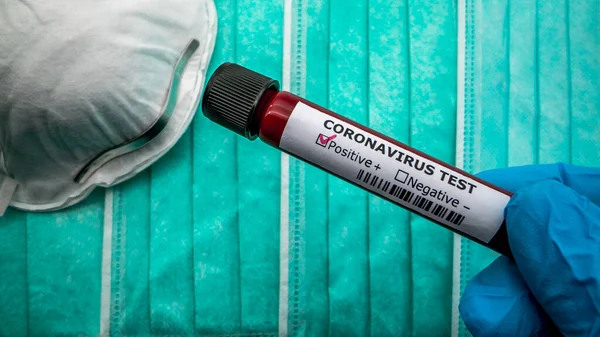 Chirurgische Maske Mit Coronavirus Covid Infizierte Blutprobe Rohr Impfstoffforschung Zum — Stockfoto