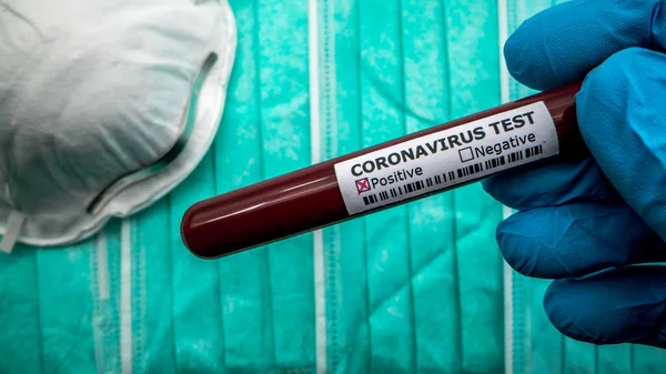 Χειρουργική Μάσκα Coronavirus Covid Μολυσμένο Δείγμα Αίματος Στο Σωλήνα Έρευνα — Φωτογραφία Αρχείου