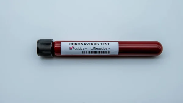 Blood Sample Tube Corona Test Covid Virus Has Caused Emergency — Stock Photo, Image