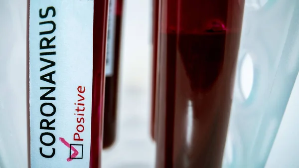 Tabung Tes Dengan Sampel Darah Yang Terinfeksi Untuk Covid Baru — Stok Foto