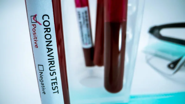 Coronavirus Covid Μολυσμένο Δείγμα Αίματος Στο Σωλήνα Έρευνα Εμβολίου Του — Φωτογραφία Αρχείου