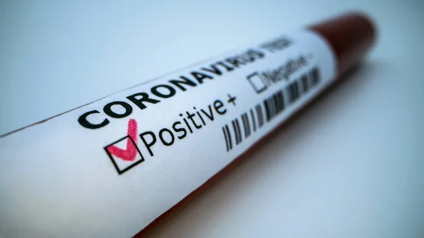 Positive Covid Test Laboratory Sample Blood Testing Diagnosis New Corona — Stock Photo, Image