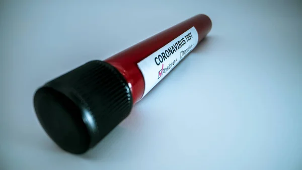 Test tube with infected blood sample for COVID-19, novel coronavirus found in Wuhan, China. Vaccine research for virus 2019-nCoV. Concept of against transmissible infectious diseases