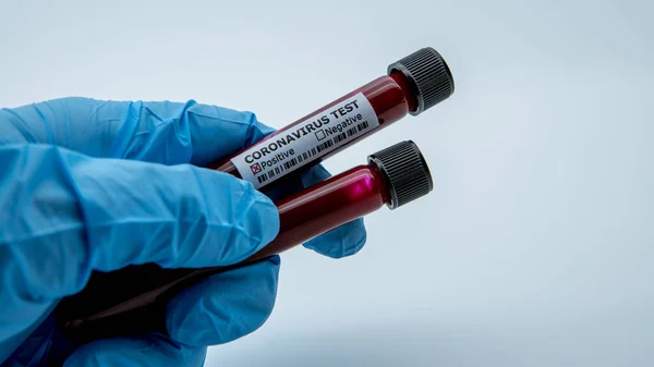 Labortechniker Halten Blutprobenröhrchen Für Coronavirus Test Covid Wissenschaftler Mit Blauen — Stockfoto