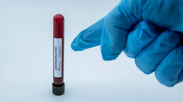 Labortechniker Halten Blutprobenröhrchen Für Coronavirus Test Covid Wissenschaftler Mit Blauen — Stockfoto