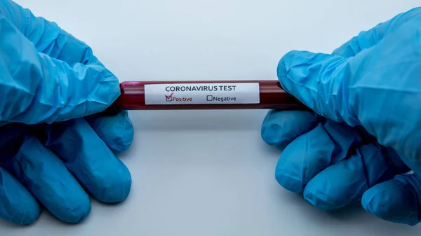 Reagenzglas Mit Infizierter Blutprobe Für Covid Neuartiges Coronavirus Das Wuhan — Stockfoto