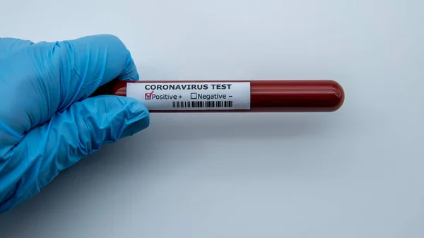 Reagenzglas Mit Infizierter Blutprobe Für Covid Neuartiges Coronavirus Das Wuhan — Stockfoto