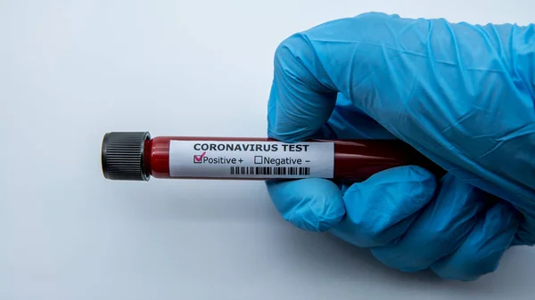 Labortechniker Halten Blutprobenröhrchen Für Coronavirus Test Covid Wissenschaftler Mit Blauen — Stockfoto