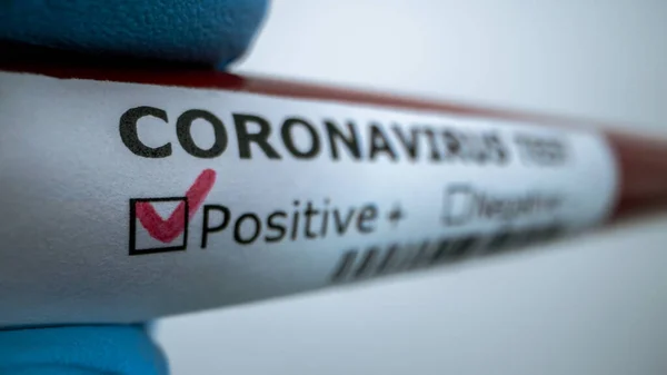 Tubul Testare Probă Sânge Infectată Pentru Covid Coronavirus Nou Găsit — Fotografie, imagine de stoc