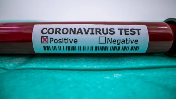 Mască Față Tub Testare Probă Sânge Infectată Pentru Covid Coronavirus — Fotografie, imagine de stoc