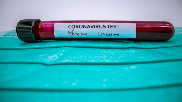 Mască Față Tub Testare Probă Sânge Infectată Pentru Covid Coronavirus — Fotografie, imagine de stoc