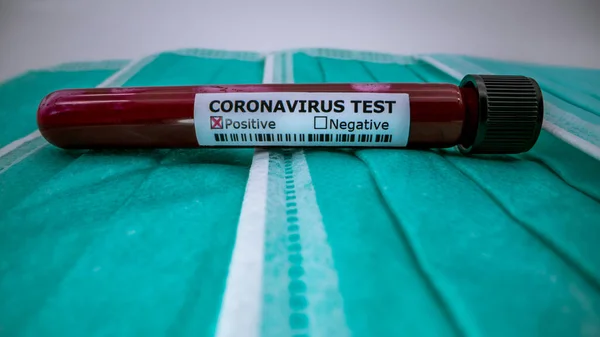 Protective Mask Positive Covid Test Laboratory Sample Blood Testing Diagnosis — Stock Photo, Image