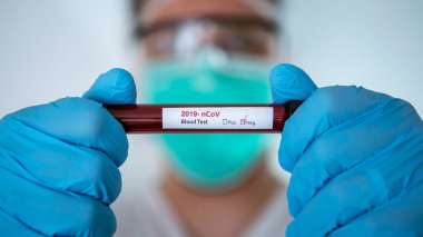 COVID-19 için negatif test tüpü olan bir adam. Wuhan, Çin 'de bulunan yeni bir koronavirüs. Korunmak için mavi eldivenli ve maskeli bilim adamı. 2019-NCoV virüsü için aşı araştırması