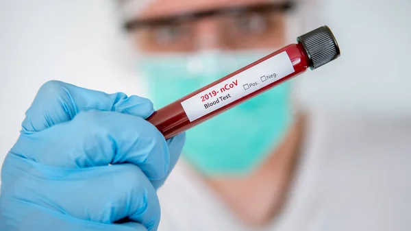 Healthcare to aid recovery from COVID-19. Scientist wear surgical gloves and mask with a coronavirus infected blood sample test. Scientist doctor biohazard protection clothing