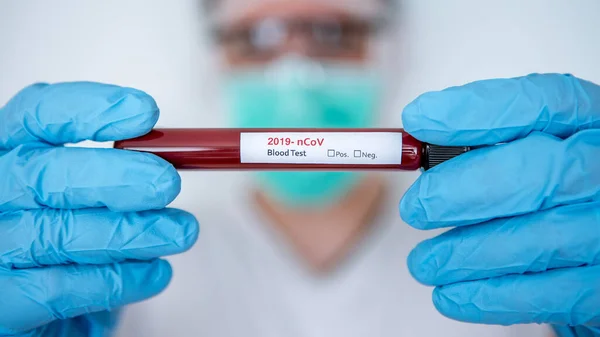Тест Covid Лабораторный Анализ Крови Диагностики Новой Коронной Вирусной Инфекции — стоковое фото