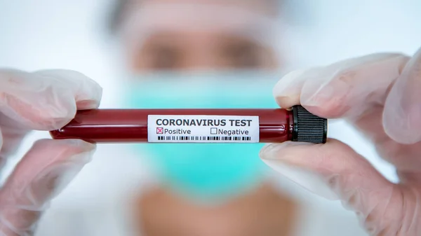 Asiatisk Kvinna Med Positivt Provrör Infekterade Blodprov För Covid Coronavirus — Stockfoto