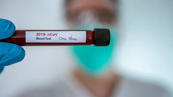 Ученый Коронавирусом Ковид Отрицательный Зараженный Образец Крови Трубке Исследование Вакцины — стоковое фото