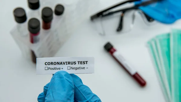 Tutkijalla Jolla Siniset Käsineet Koronavirustestiä Varten Tunnistetarra Covid Virus Aiheuttanut — kuvapankkivalokuva