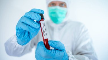 Koruyucu kıyafetli bir erkek bilim adamı ve laboratuvarda COVID-19 testi pozitif çıktı. Yeni Corona virüsü enfeksiyonu teşhisi için kan testi. Wuhan 'dan 2019 numaralı hastalık. Bulaşıcı salgın konsepti