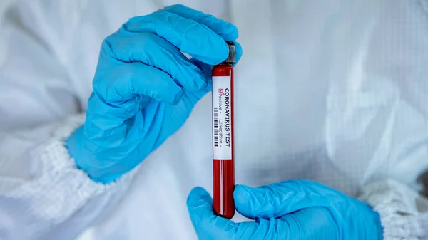 Hombre Con Probeta Positiva Muestra Sangre Infectada Para Covid Coronavirus —  Fotos de Stock