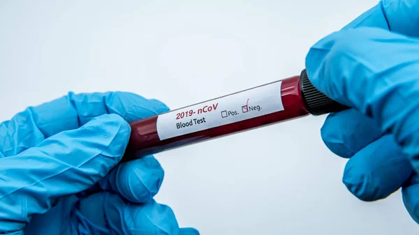 Tubul Testare Probă Sânge Negativă Pentru Covid Coronavirus Nou Găsit — Fotografie, imagine de stoc