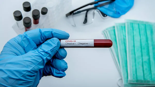 Técnico Laboratório Segurar Mão Tubo Amostra Sangue Para Teste Corona — Fotografia de Stock