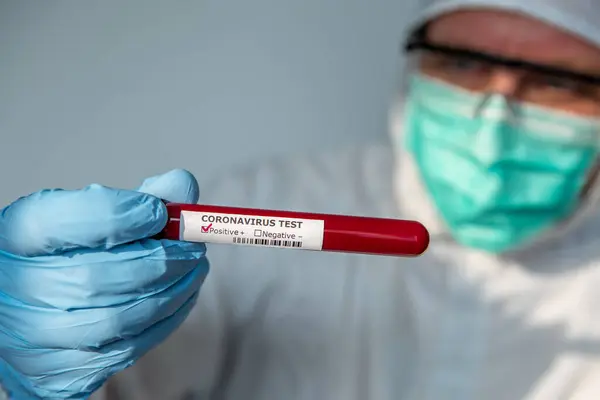 Laboratorietekniker Man Hand Hålla Positiva Blodprov Röret För Koronavirus Test — Stockfoto