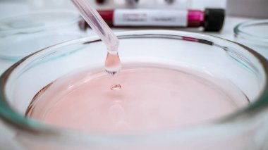 Bilim adamı Petri kabına örnek bırakıyor. Laboratuvarda pipetle deneyler yaptım. Tıbbi testler için biyokimya testi sıvısı ekledim. Petrischalen Laboratuvarında ekipman ve bilim deneyleri