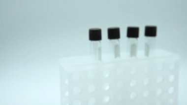 4K, COVID-19 'un iyileşmesine yardımcı olmak için sağlık hizmeti. Koronavirüsü pozitif olan ameliyat eldivenleri kan örneğini etkiledi. Bilim adamı doktorun eli biyolojik tehlike koruma giysisi Dan.