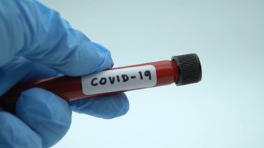 4K, COVID-19 'un iyileşmesine yardımcı olmak için sağlık hizmeti. Koronavirüsü pozitif olan ameliyat eldivenleri kan örneğini etkiledi. Bilim adamı doktorun eli biyolojik tehlike koruma giysisi Dan.