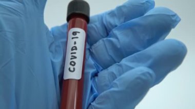 4K, Coronavirus Covid 19 tüpte enfekte olmuş kan örneği. 2019-NCoV virüsünün aşı araştırması laboratuvarda. Wuhan 'dan 2019 numaralı hastalık. Bulaşıcı bulaşıcı konsept - Dan