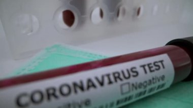 4K, yüz maskesi ve COVID-19 için enfekte kan örneği içeren test tüpü, Wuhan, Çin 'de bulunan yeni bir coronavirüs. Koruma için mavi eldivenli bilim adamı. 2019-nCoV-Dan virüsü için aşı araştırması