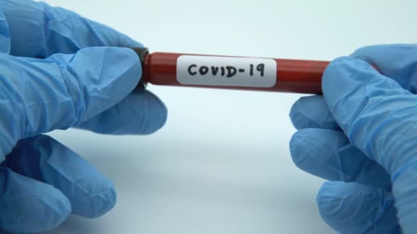 Test Positif Covid Échantillon Laboratoire Tests Sanguins Pour Diagnostic Nouvelle — Video