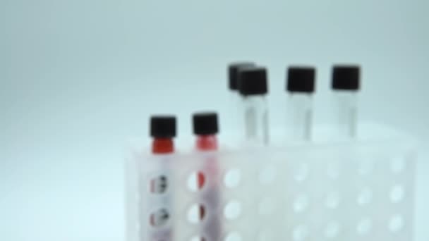 コロナウイルスCovid 19感染した血液サンプルチューブ 研究室でのウイルス2019 Ncovのワクチン研究 武漢からの病気2019 パンデミック感染の概念 Dan — ストック動画