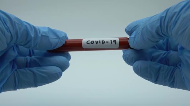 Teste Positivo Covid Amostra Laboratorial Exames Sangue Para Diagnóstico Nova — Vídeo de Stock