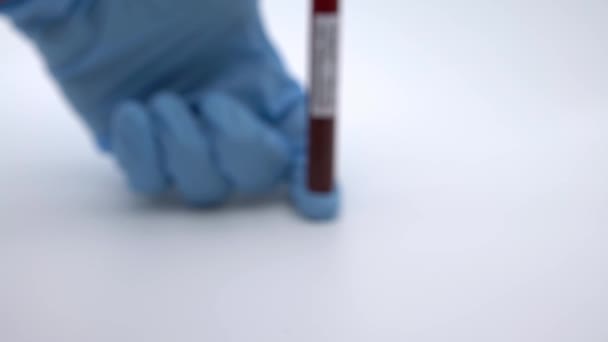 保護マスクと正のCovid 19テスト 新しいコロナウイルス感染を診断するための血液検査の実験室サンプル 武漢からの病気2019 パンデミック感染の概念 Dan — ストック動画