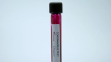 4K, korona testi için kan örneği tüpü, COVID-19. Virüs acil duruma neden oldu. Aşı araştırması 2019-NCoV. Bulaşıcı bulaşıcı hastalıklara karşı araştırma ve grip-Dan korunması