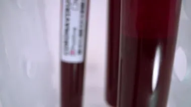 4K, COVID-19 için enfekte kan örneği içeren test tüpü, Wuhan, Çin 'de bulunan yeni bir koronavirüs. 2019-NCoV virüsü için aşı araştırması. Bulaşıcı bulaşıcı hastalıklara karşı kavram - Dan