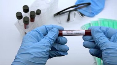 4K, yüz maskesi ve COVID-19 için enfekte kan örneği içeren test tüpü, Wuhan, Çin 'de bulunan yeni bir coronavirüs. Koruma için mavi eldivenli bilim adamı. 2019-nCoV-Dan virüsü için aşı araştırması