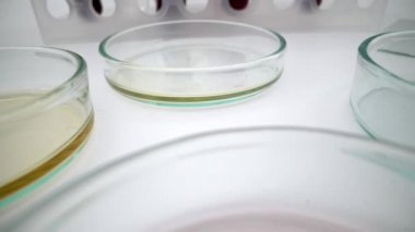 4K, beyaz arka planda Petri kaplarında kimyasal araştırma. Mikrobiyoloji laboratuvarında plaka hazırlıyorum. Plakalar yerleştiriliyor. Aşı ampulü. Kimyasal sıvı Dan içeren mikrobiyoloji laboratuarı camları.