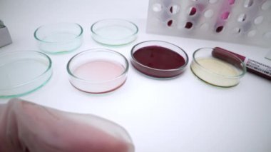 4K, Coronavirus kan örneğini enfekte etti. Laboratuvarda Corona virüsünü analiz eden bir bilim adamı. Covid-19 şu anda virüse karşı virüsü tedavi edecek bir ilaç bulmaya çalışıyor. - Dan.