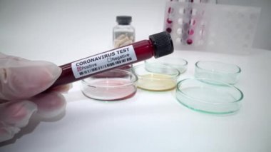 4K, Roman Coronavirus hapları ve beyaz arka planda kan testi tüpü. Covid-19 şu anda virüse karşı virüsü tedavi edecek bir ilaç bulmaya çalışıyor. 2019-NCoV konseptini tedavi etmek için. - Dan.