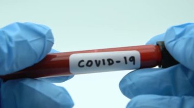 COVID-19 için enfekte kan örneği içeren Yavaş Tüp Hareketi, Wuhan, Çin 'de bulunan yeni Coronavirüs. Koruma için mavi eldivenli bilim adamı. 2019-nCoV-Dan virüsü için aşı araştırması