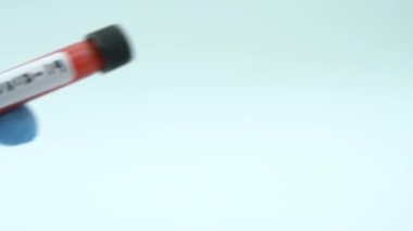 Coronavirus Covid 19 'un Yavaş Hareketi tüpte enfekte olmuş kan örneği. 2019-NCoV virüsünün aşı araştırması laboratuvarda. Wuhan 'dan 2019 numaralı hastalık. Bulaşıcı bulaşıcı konsept - Dan