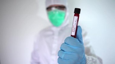 4K, koruyucu giysili erkek bilim adamı. COVID-19 için negatif kan tübü olan ve baş parmağını veren beyaz bir adam. Sonuç iyi. Coronavirus-Dan aşısı araştırması